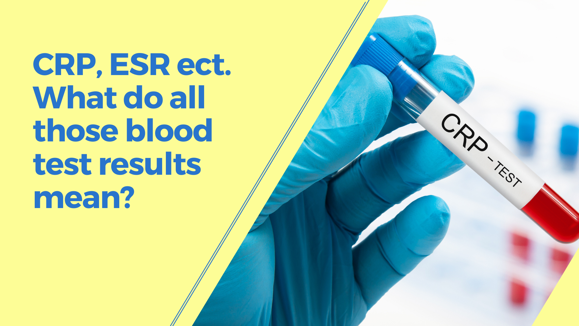 CRP, ESR ect. What do all those blood test results mean?